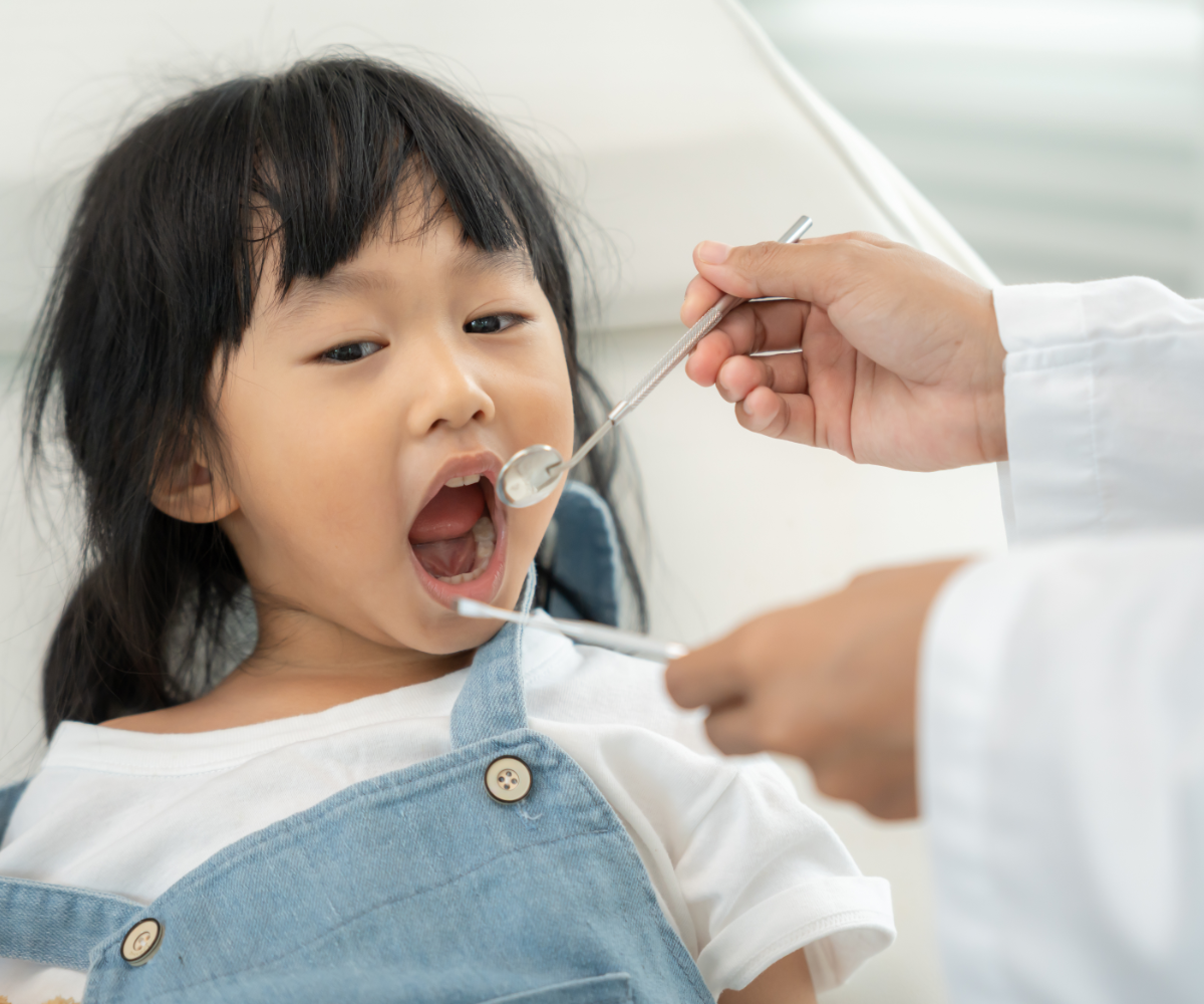 お子様の虫歯予防を行う小児歯科のイメージ